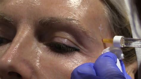 Injection Modeling 的图像结果