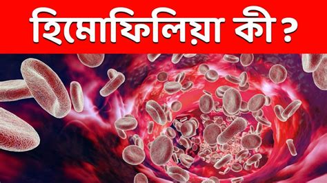 Hemophilia blood clotting disease - Haemophilia Blood Disease: রক্ত ...