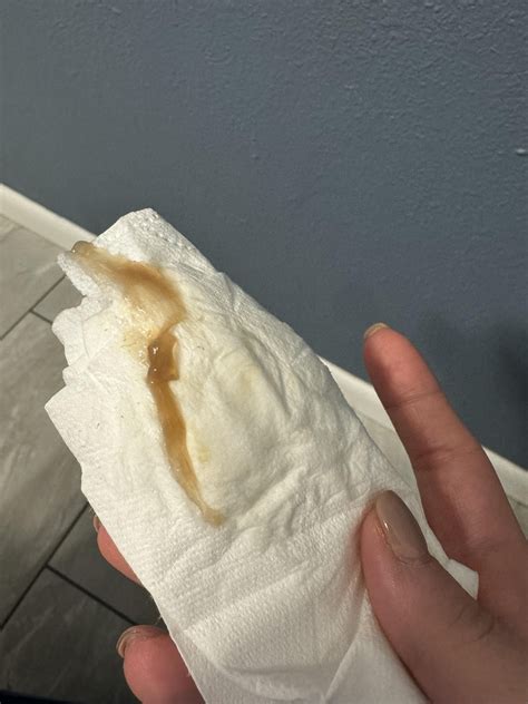 Brownish Discharge During Ovulation Why Do I Have Brown Discharge?