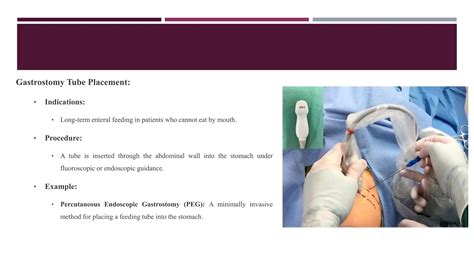 Interventional Radiology Procedures.pptx
