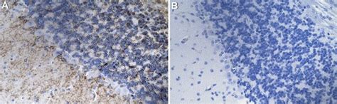 Anti-Glucuronoxylomannan/GXM Antibody, clone 3E5 | MABF3125-25UG