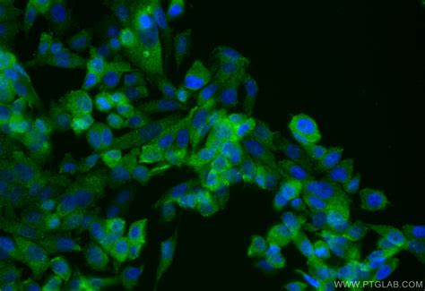 PNMA1 antibody (68415-1-PBS) | Proteintech