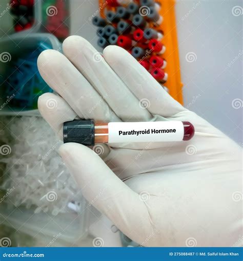 Biochemist Hold a Blood Sample for Parathyroid Hormone (PTH) Test Stock ...