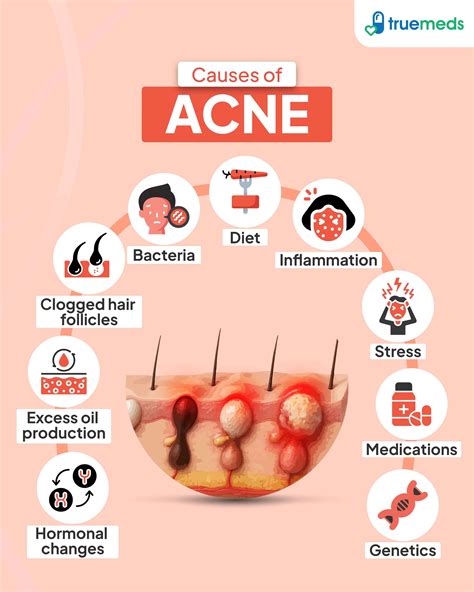 Can Irritation Cause Acne