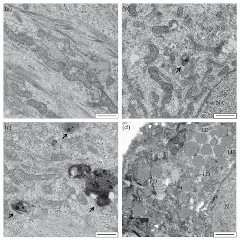 Cardiomyocytes Derived from Induced Pluripotent Stem Cells as a Disease ...