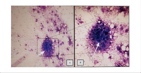 Image result for Diff Quick Stain