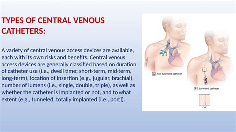 Central venous access devices all you need to know | PPTX