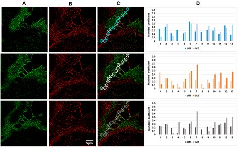 Colocalization Analysis of Cytoplasmic Actin Isoforms Distribution in ...