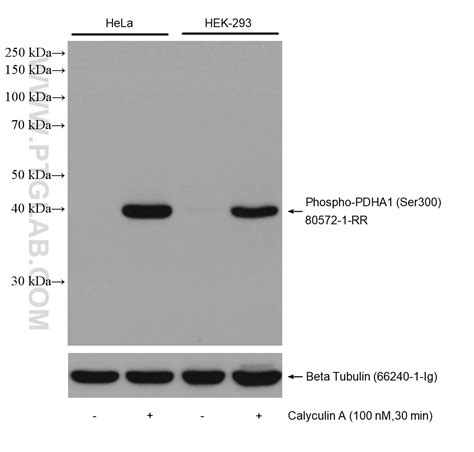 Phospho-PDH E1 Alpha (Ser300) antibody (80572-1-RR) | Proteintech