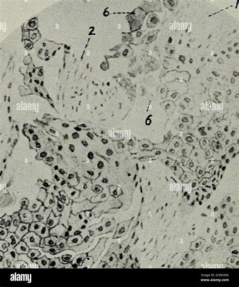 Stone in bile duct hi-res stock photography and images - Alamy