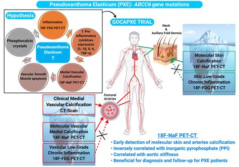 Assessment of Inflammation and Calcification in Pseudoxanthoma ...