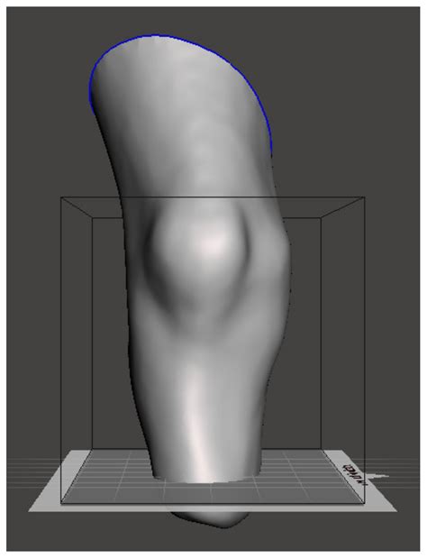 Three-Dimensional (3D) Model-Based Lower Limb Stump Automatic Orientation