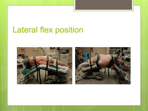 prone versus supine pcnl | PPTX
