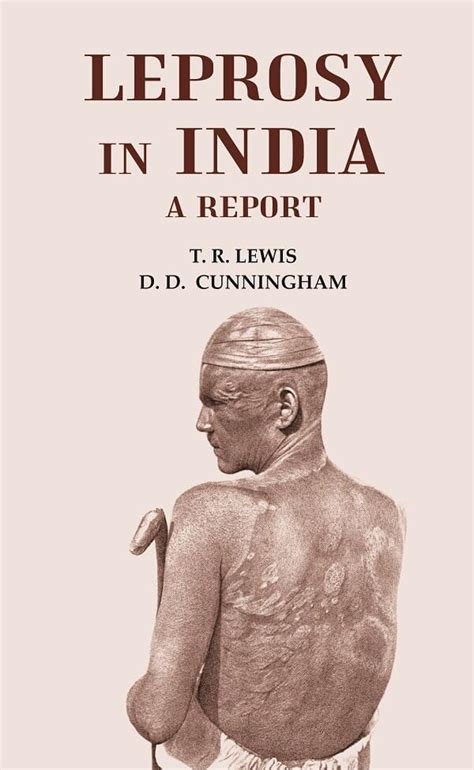 Leprosy in India [Hardcover] : T. R. Lewis and D. D. Cunningham: Amazon ...