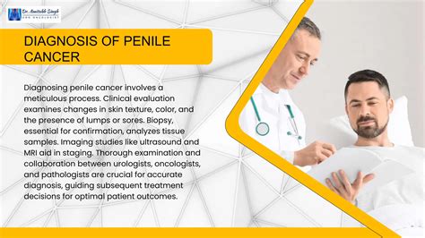 know about penile cancer: Diagnosis, Symptoms | PPTX | Sexual Conditions | Sexual Health