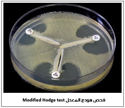 بكتيريا الراكدة البومانية - Arsco