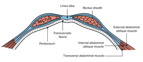 Surgical Anatomy of the Abdomen | Concise Medical Knowledge