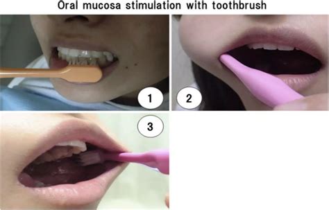 Preoperative Tooth Cleaning Reduces Postoperative Pneumonia Risk in ...