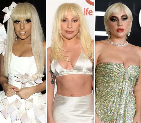 Did Lady Gaga Get Plastic Surgery? What She's Said About It | Life & Style