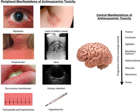 Anticholinergics - Clinical Tree