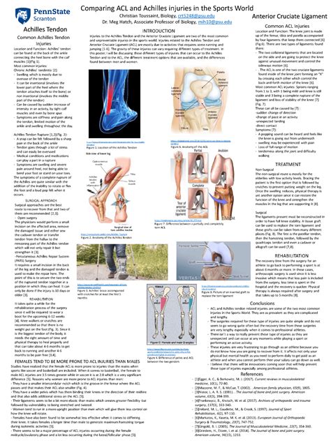 #2-S Comparing ACL and Achilles Injuries in the Sports World ...
