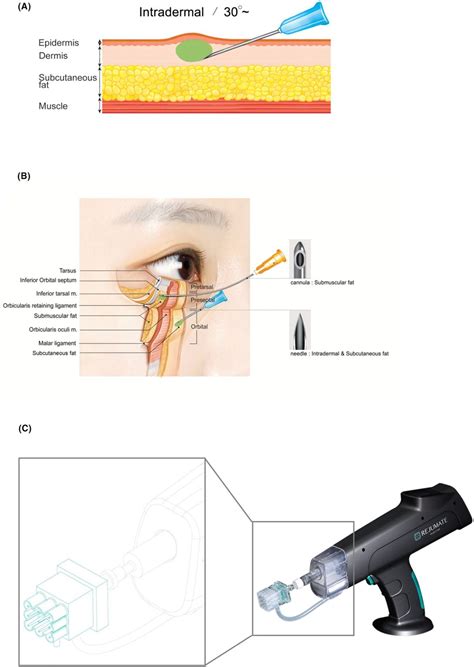 Salmon Sperm Facials & PDRN Skincare - Dr Rachel Ho