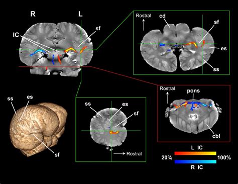 First images of dolphin brain circuitry hint | EurekAlert!