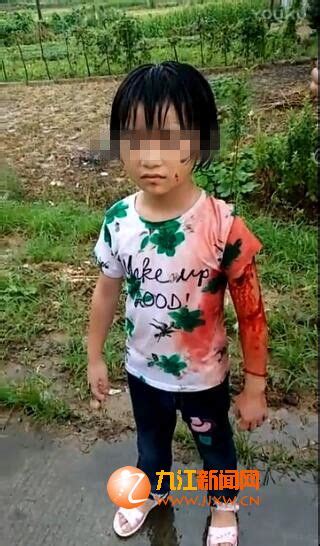 8岁女孩遭陌生女从教室拐走砍伤 独行数公里顽强逃生_凤凰网
