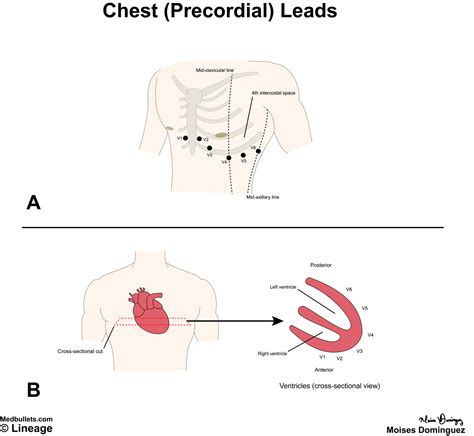 Electrocardiogram (ECG) | USMLE Strike