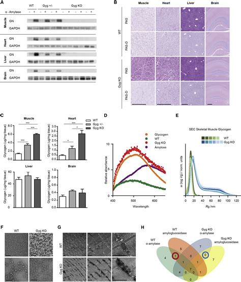 Lack of Glycogenin Causes Glycogen Accumulation and Muscle Function ...
