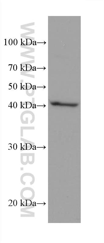 AIFM2/ FSP1 antibody (68049-1-Ig) | Proteintech