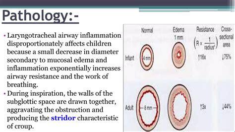 Approach to Acute infective upper airway obstruction (infective stridor ...