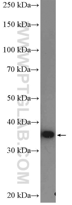 AMPK Beta 1 antibody (26907-1-AP) | Proteintech