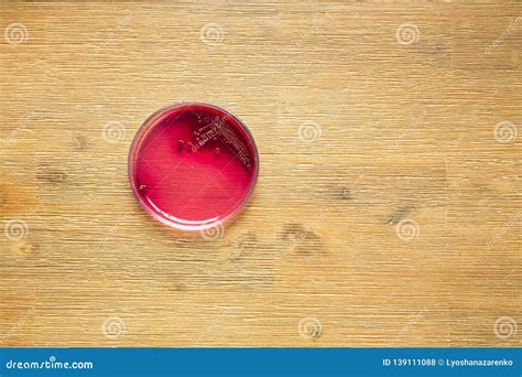 Staphylococcus Aureus Bacteria in Blood Agar Plate Stock Photo - Image ...