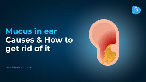 Swollen Lymph Nodes Behind Ear: Causes & Treatment