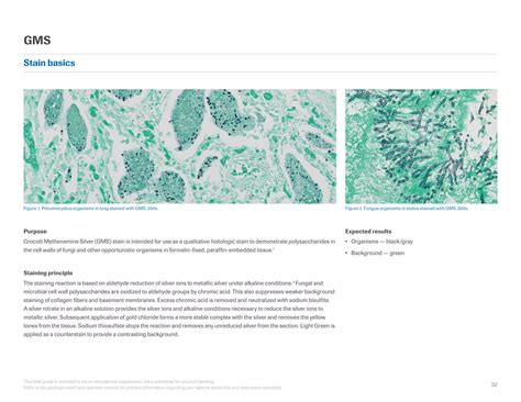 VENTANA BenchMark Special Stains General Reference Guide | PDF