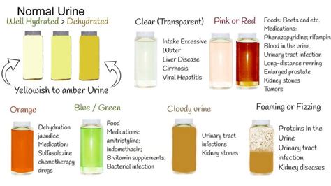 lyme disease urine color