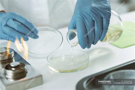 Petri Dish Of Agar at Andrea Burnside blog