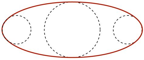 Design Specifications for an Auxiliary Incision Retractor in ...