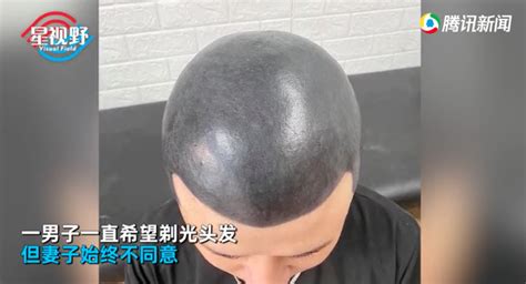 越南男子剃光头后怕被妻子发现，竟把头皮纹成黑色！结果悲剧了 | 北晚新视觉