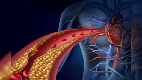 Health Tips: কোলেস্টেরল জব্দ! ওষুধের ঝামেলা নেই, হার্ট ভাল রাখতে ...