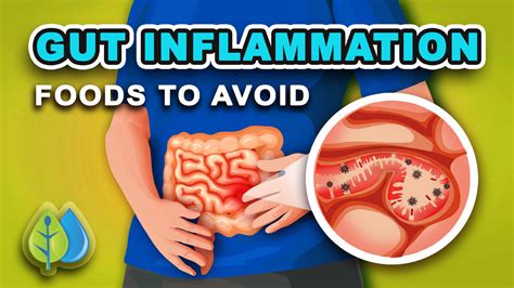 What Are The Top 5 Foods That Cause Inflammation at Becky Moreno blog