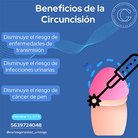 Circuncisión láser