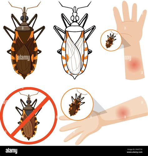 Human arm swollen from kissing bug bite illustration Stock Vector Image ...