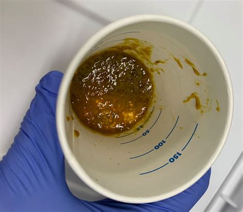 Mucoid Diarrhea