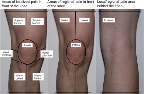 Associations between MRI-defined structural pathology and generalized ...