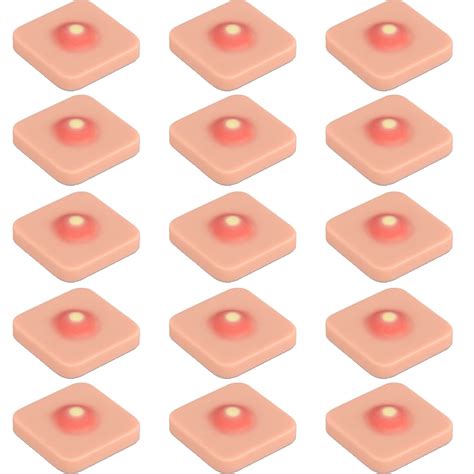 Abscess Incision Drainage Pad Sebaceous Cyst Removal Trainer Abscess ...