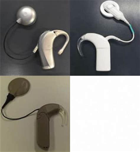 通耳G01医用可视采耳设备可视采耳仪器可视耳镜高清内窥镜可拍照-阿里巴巴