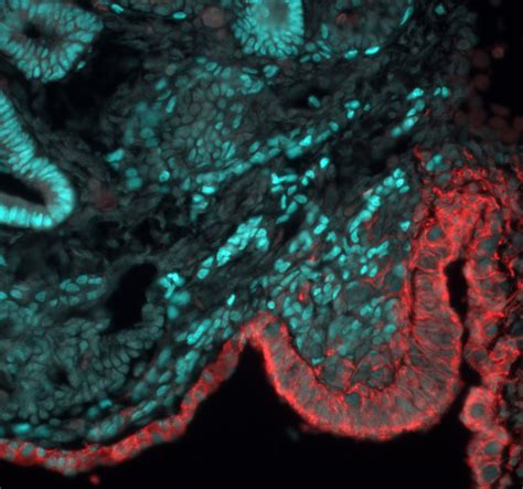 Decoding Dmrt1: Insights into vertebrate sex determination and gonadal sex differentiation