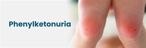Phenylketonuria: Symptoms, Causes, and Treatment